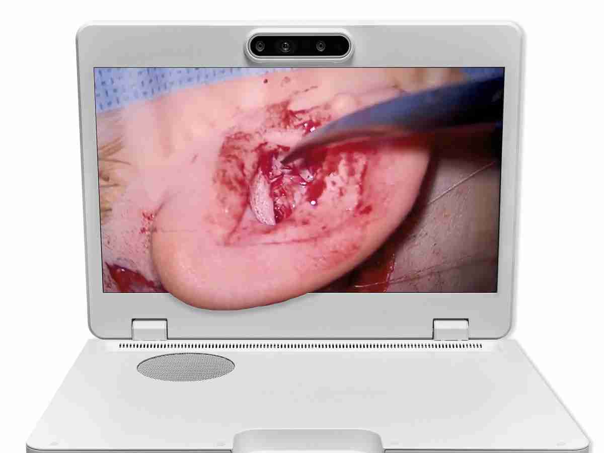 达擎之＂Heads-up 3D显微手术显示系统＂，，，整合4K裸眼3D显示及眼球追踪系统，，具备快速追踪人眼移动位置功能，，减轻医师长时间维持固定姿势的负担，，，让医师能有更宽广清晰的3D立体视野及更舒适的姿势来执行手术。。